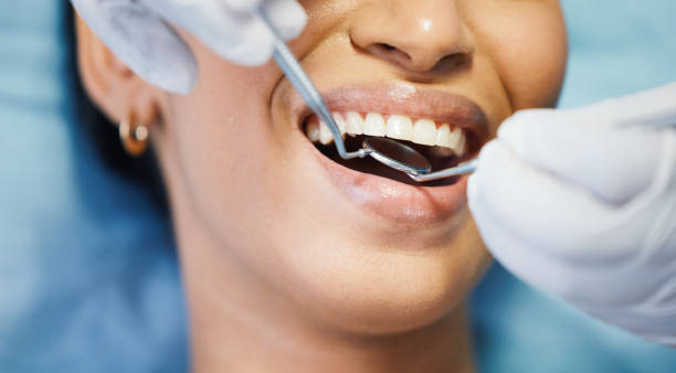 Best Emergency Dental Care for Broken or Chipped Teeth in Brandon, MS