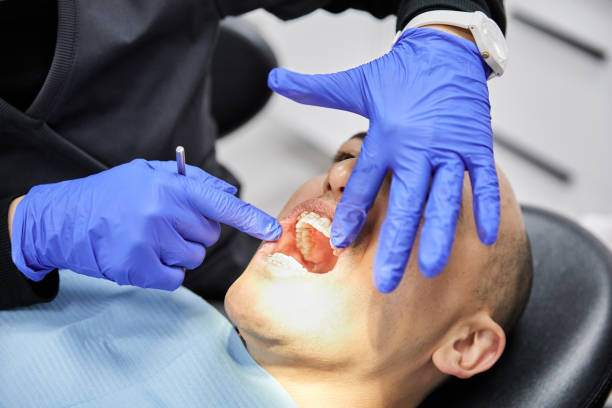 Best Emergency Wisdom Teeth Removal in Brandon, MS